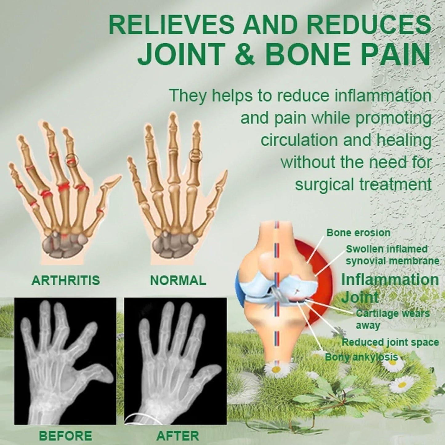 Joint & Muscle Relief | Bee Venom Pain Relief Cream 🔥 Buy 1 get 2 FREE