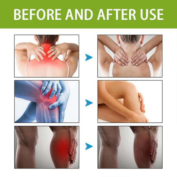 Joint & Muscle Relief | Bee Venom Pain Relief Cream 🔥 Buy 1 get 2 FREE