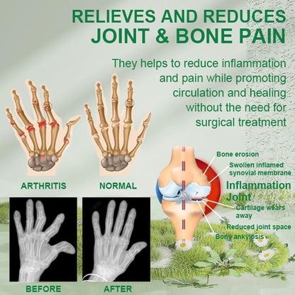 Joint & Muscle Relief | Bee Venom Pain Relief Cream 🔥 Buy 1 get 2 FREE